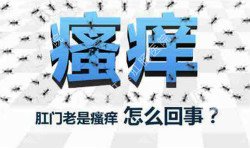 肛門瘙癢治不好嗎？先檢查病因就好辦！